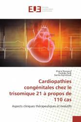 Cardiopathies congénitales chez le trisomique 21 à propos de 110 cas