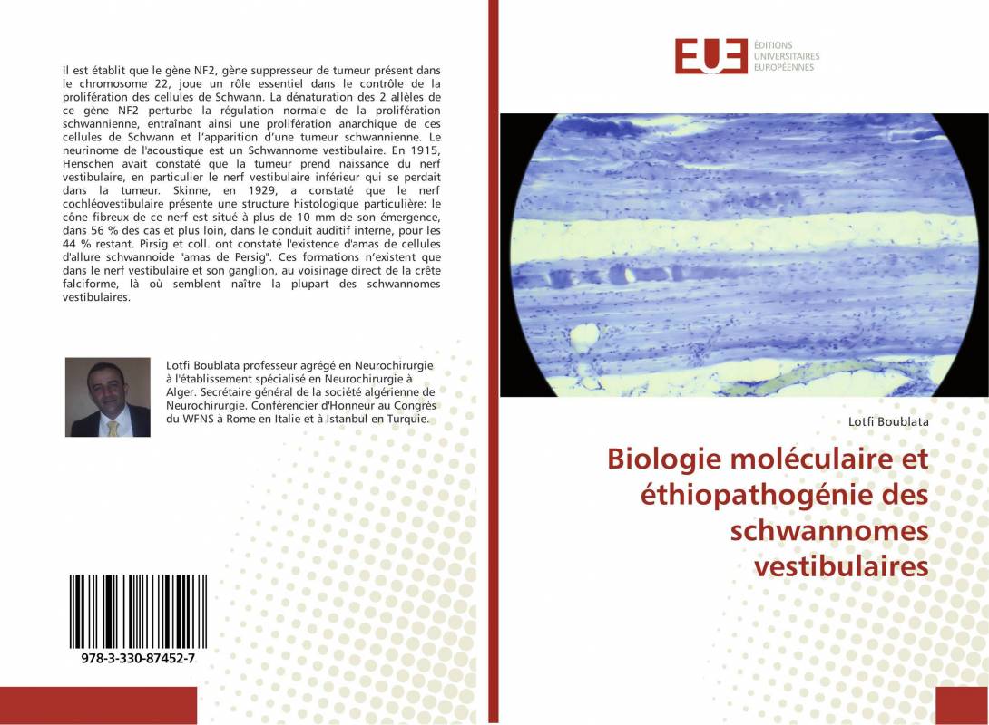 Biologie moléculaire et éthiopathogénie des schwannomes vestibulaires