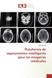 Plateforme de segmentation intelligente pour les imageries médicales