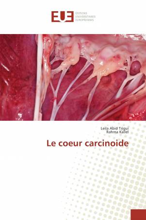 Le coeur carcinoide