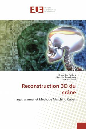Reconstruction 3D du crâne