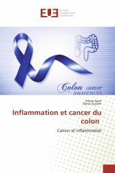 Inflammation et cancer du colon