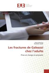 Les fractures de Galeazzi chez l’adulte