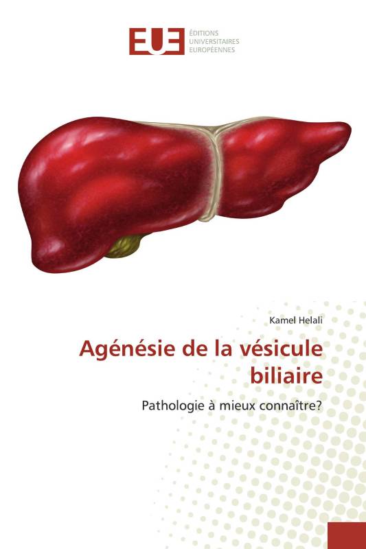 Agénésie de la vésicule biliaire