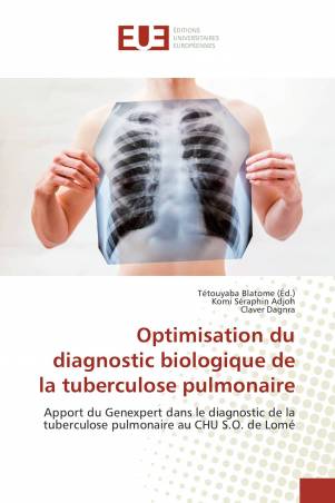 Optimisation du diagnostic biologique de la tuberculose pulmonaire