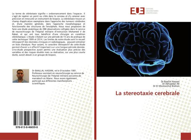 La stereotaxie cerebrale