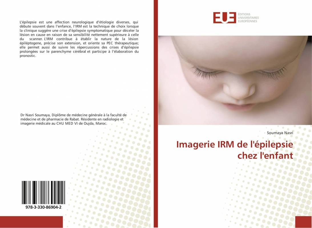 Imagerie IRM de l'épilepsie chez l'enfant