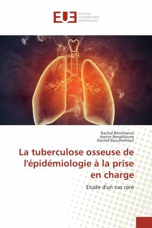 La tuberculose osseuse de l&#039;épidémiologie à la prise en charge