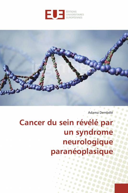 Cancer du sein révélé par un syndrome neurologique paranéoplasique
