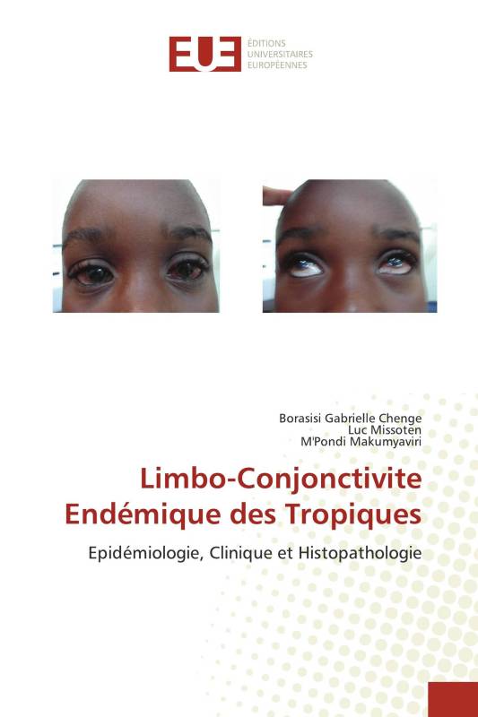 Limbo-Conjonctivite Endémique des Tropiques