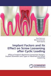 Implant Factors and Its Effect on Screw Loosening after Cyclic Loading