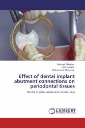 Effect of dental implant abutment connections on periodontal tissues