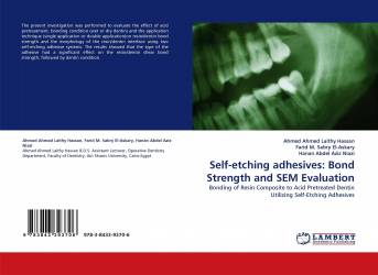Self-etching adhesives: Bond Strength and SEM Evaluation