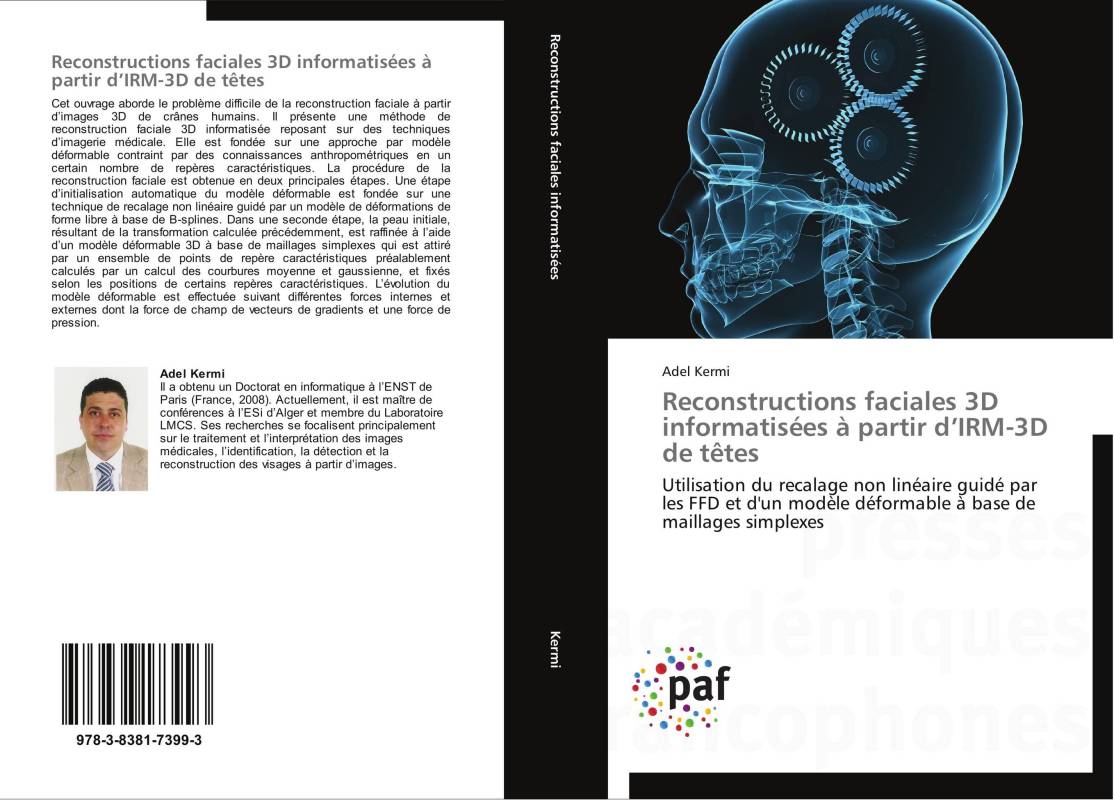 Reconstructions faciales 3D informatisées à partir d’IRM-3D de têtes