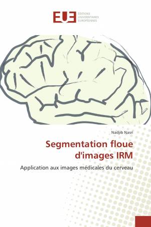 Segmentation floue d'images IRM