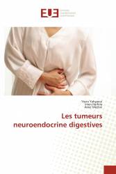 Les tumeurs neuroendocrine digestives