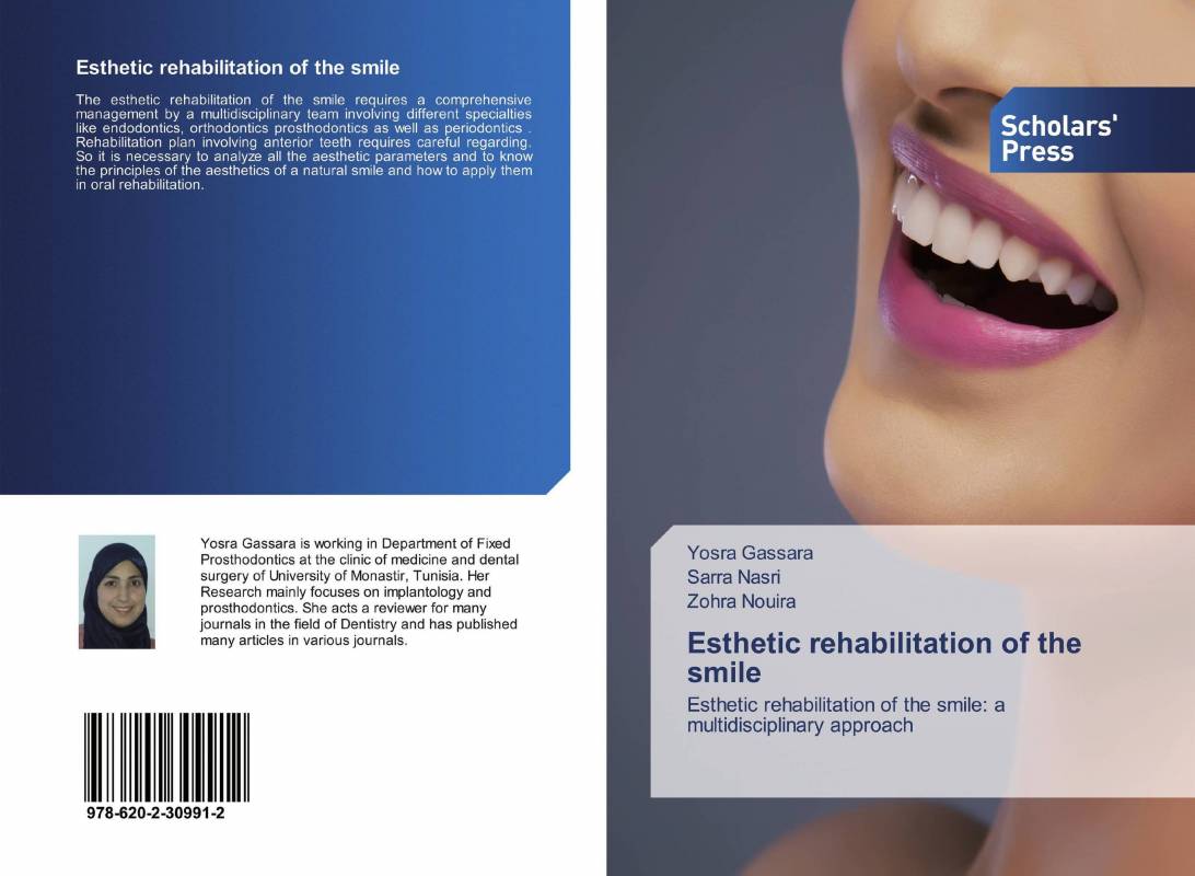 Esthetic rehabilitation of the smile