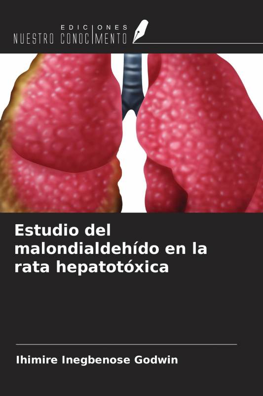 Estudio del malondialdehído en la rata hepatotóxica