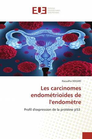 Les carcinomes endométrioïdes de l'endomètre