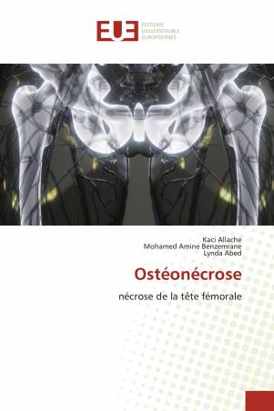 Ostéonécrose