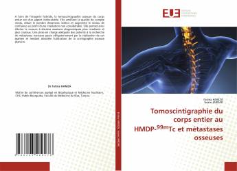 Tomoscintigraphie du corps entier au HMDP-99mTc et métastases osseuses
