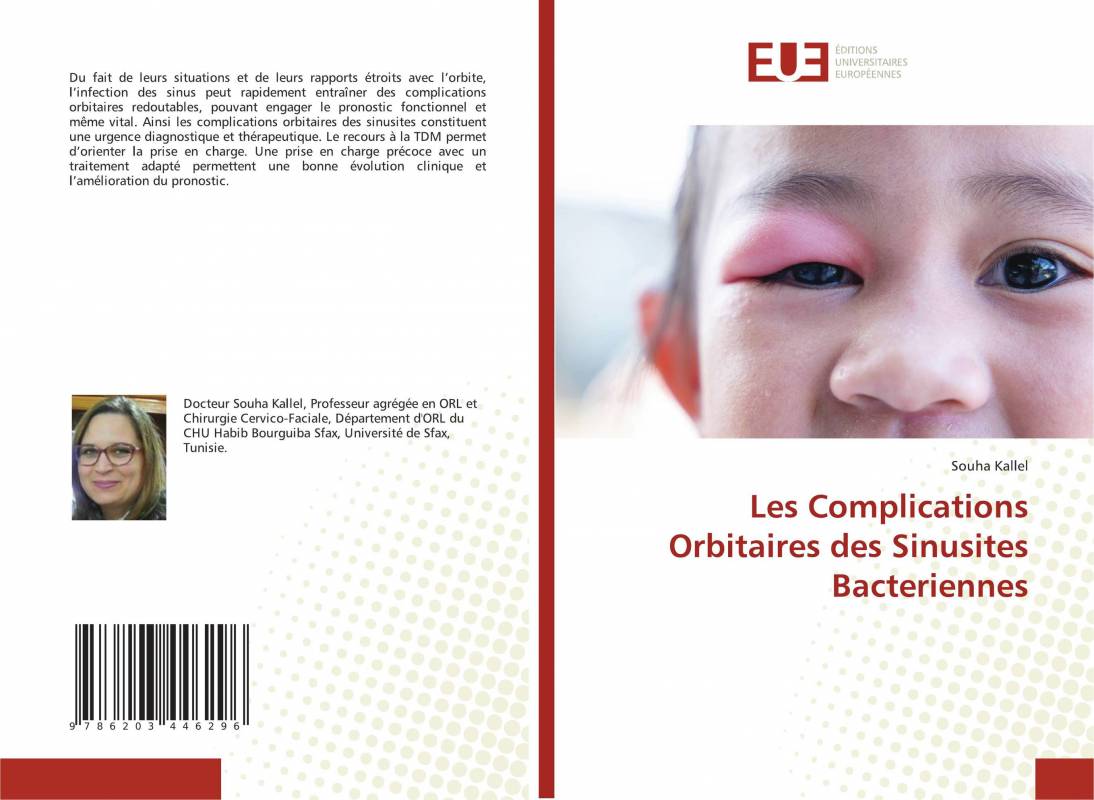 Les Complications Orbitaires des Sinusites Bacteriennes