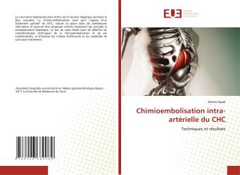 Chimioembolisation intra-artérielle du CHC