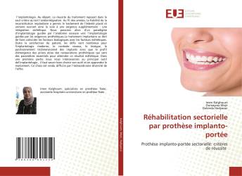 Réhabilitation sectorielle par prothèse implanto-portée