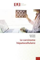 Le carcinome hépatocellulaire