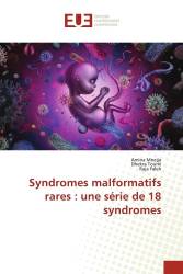 Syndromes malformatifs rares : une série de 18 syndromes