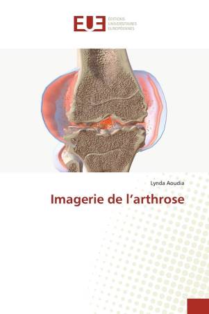 Imagerie de l’arthrose