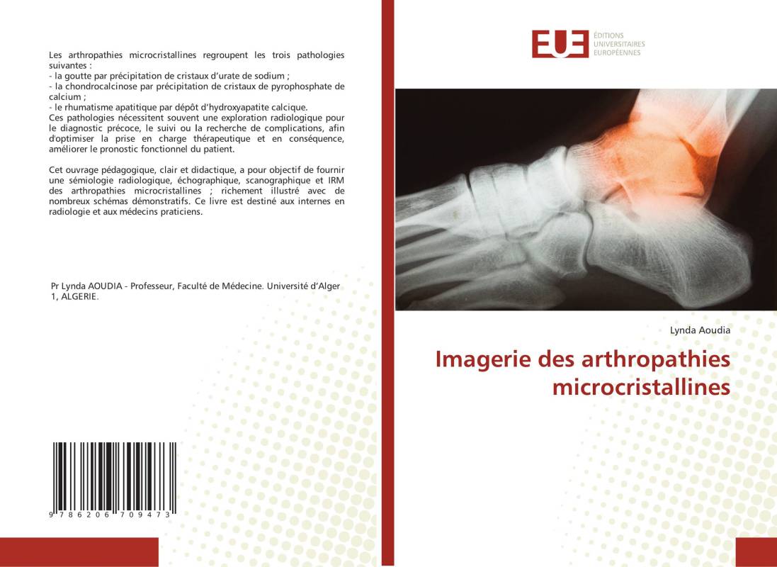 Imagerie des arthropathies microcristallines