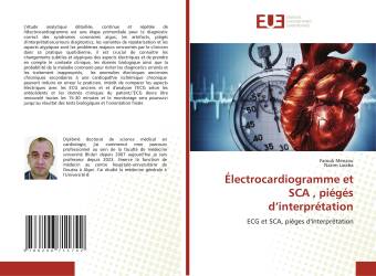 Électrocardiogramme et SCA , piégés d’interprétation