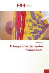 Échographie des kystes mammaires