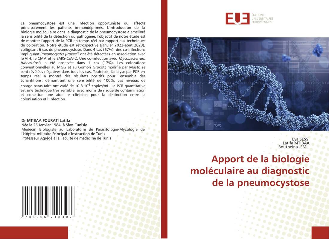 Apport de la biologie moléculaire au diagnostic de la pneumocystose