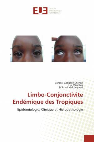 Limbo-Conjonctivite Endémique des Tropiques