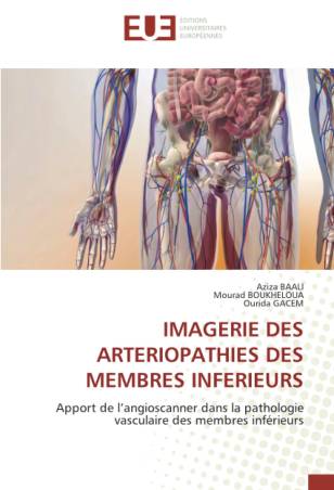 IMAGERIE DES ARTERIOPATHIES DES MEMBRES INFERIEURS