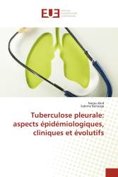 Tuberculose pleurale: aspects épidémiologiques, cliniques et évolutifs