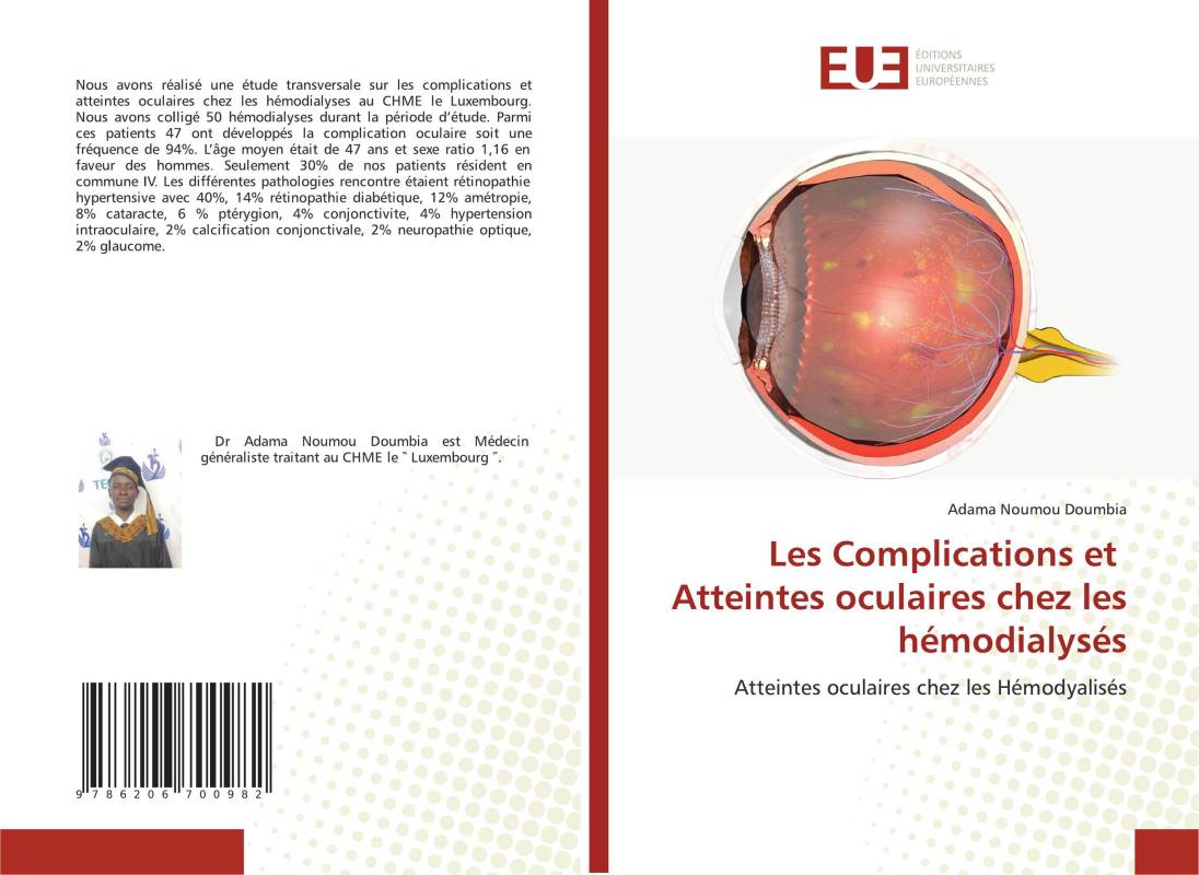 Les Complications et Atteintes oculaires chez les hémodialysés