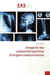 Imagerie des ostéoarthropathies d’origine endocrinienne