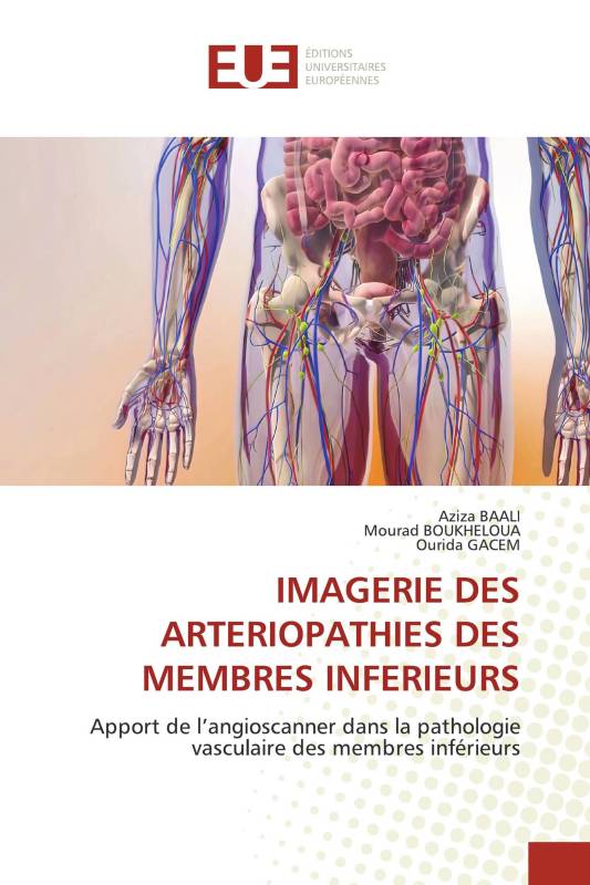 IMAGERIE DES ARTERIOPATHIES DES MEMBRES INFERIEURS