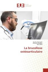 La brucellose ostéoarticulaire