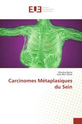 Carcinomes Métaplasiques du Sein