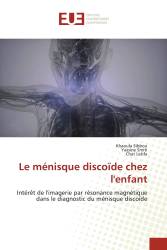 Le ménisque discoïde chez l'enfant