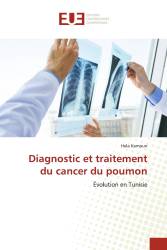 Diagnostic et traitement du cancer du poumon