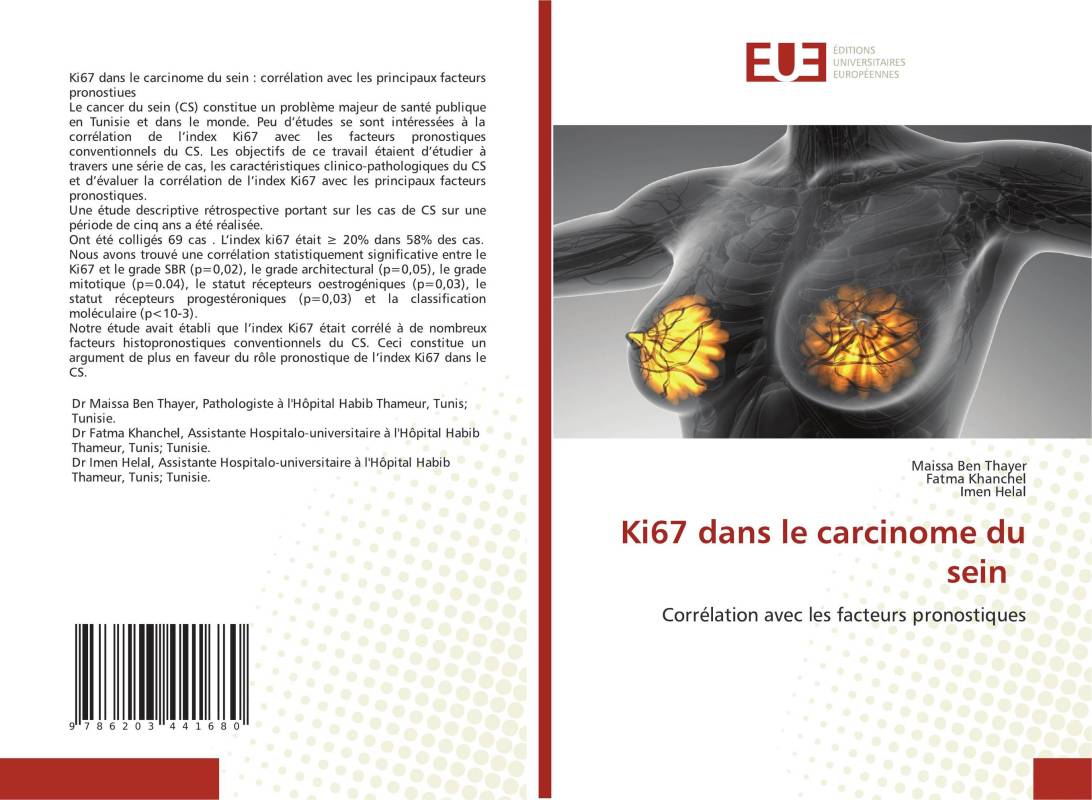 Ki67 dans le carcinome du sein