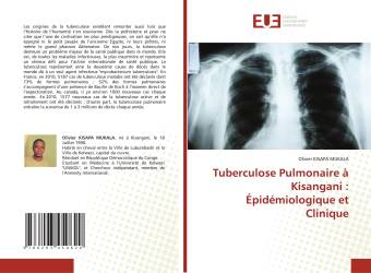 Tuberculose Pulmonaire à Kisangani : Épidémiologique et Clinique