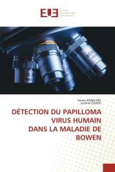 DÉTECTION DU PAPILLOMA VIRUS HUMAIN DANS LA MALADIE DE BOWEN