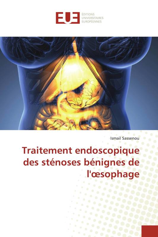 Traitement endoscopique des sténoses bénignes de l'œsophage