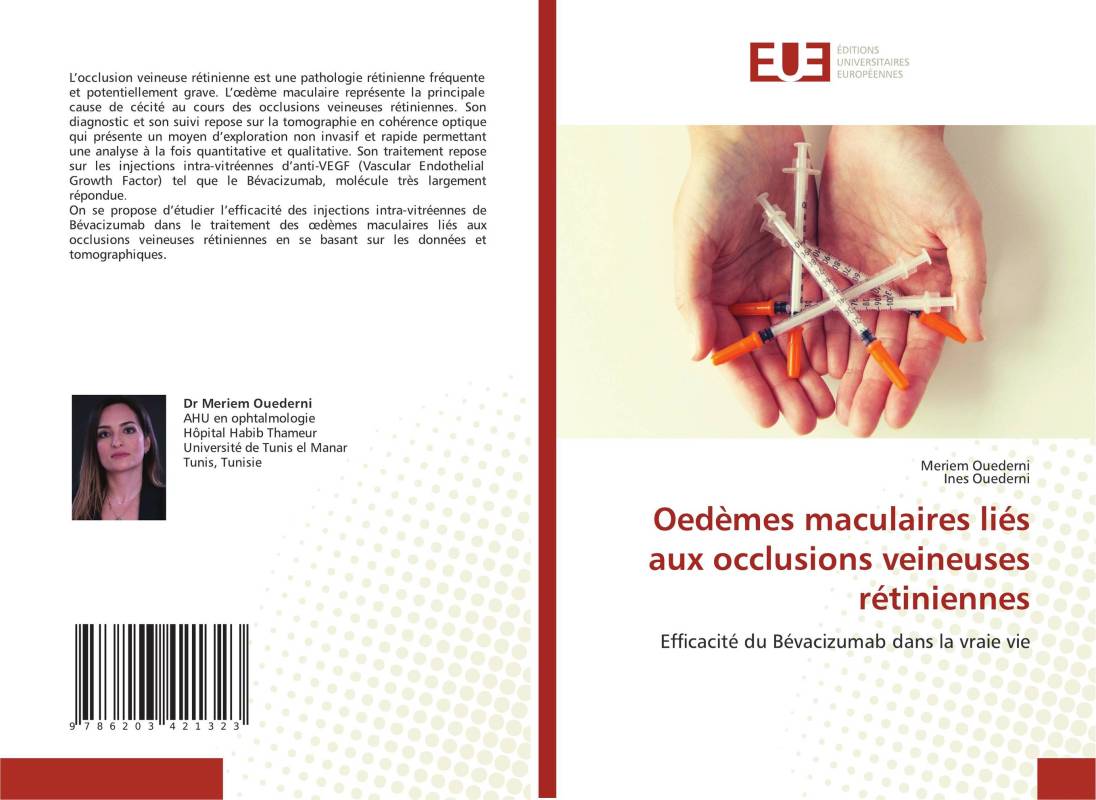 Oedèmes maculaires liés aux occlusions veineuses rétiniennes